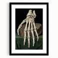 Dark Academia Wall Art - Gothic Skeleton Hand for Moody Aesthetic Decor